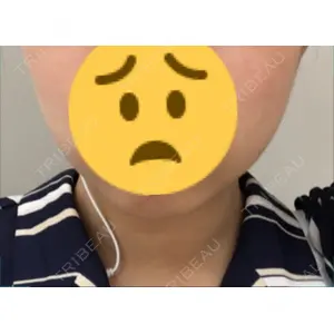 赤坂プレミアクリニック口コミ