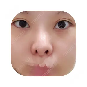 ソウルクイーン整形外科（旧コエンミ整形外科）口コミ