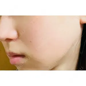 Tokyo Tensei Clinic Tokyo Tensei Clinic 銀座院口コミ