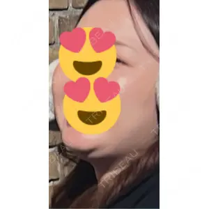 口コミ