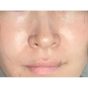くさのたろうクリニック口コミ