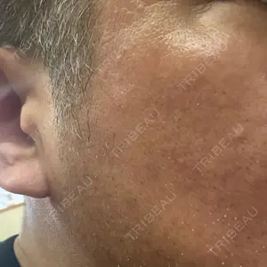 ルラ美容クリニック ルラ美容クリニック銀座院口コミ
