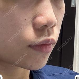 ASTRA BEAUTY CLINICの