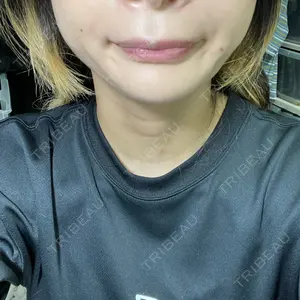 TCB東京中央美容外科 TCB東京中央美容外科 横浜院口コミ