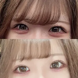 東京シンデレラ美容外科 東京シンデレラ美容外科 池袋院口コミ