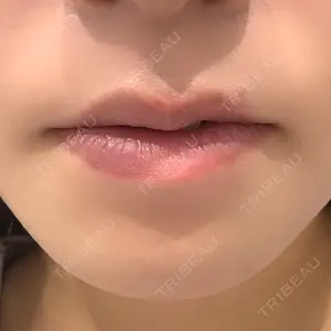 R Beauty CLINIC R Beauty CLINIC 銀座院口コミ