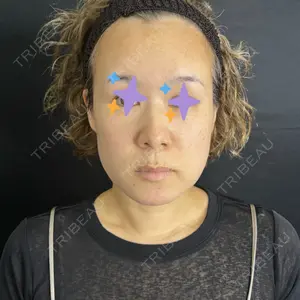 藤・ナチュレ美容クリニック 藤・ナチュレ美容クリニック 銀座院口コミ