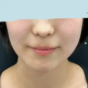 口コミ