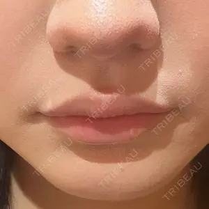 R Beauty CLINIC R Beauty CLINIC 銀座院口コミ
