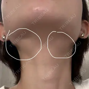 BiBiクリニック口コミ