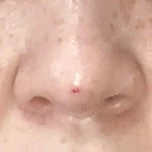 渋谷の森クリニック口コミ