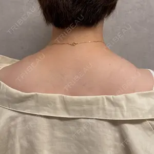 BiBiクリニック口コミ