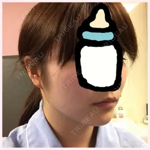 TL美容整形外科 TL美容整形外科 顔面輪郭・目・鼻センター口コミ