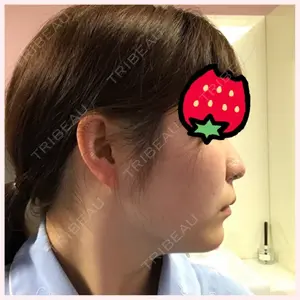 TL美容整形外科 TL美容整形外科 顔面輪郭・目・鼻センター口コミ