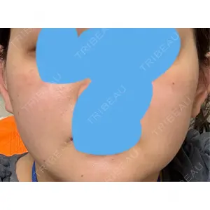 聖心美容クリニック グループ S-Laboクリニック 渋谷院口コミ