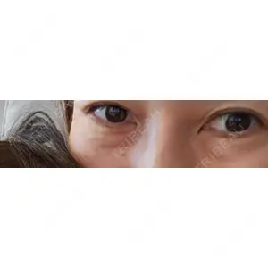 APOLLO BEAUTY CLINIC口コミ