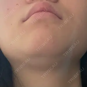 渋谷美容外科クリニック 渋谷美容外科クリニック 新宿院口コミ
