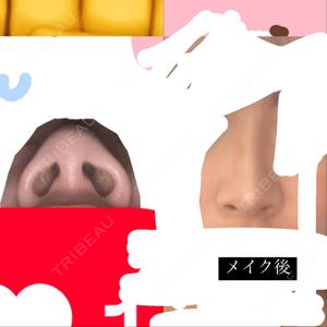口コミ
