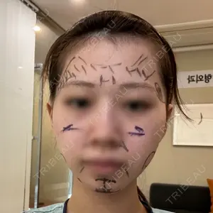 セギム美容整形外科口コミ