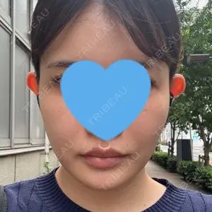 口コミ