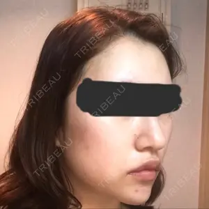 TL美容整形外科 TL美容整形外科 顔面輪郭・目・鼻センター口コミ