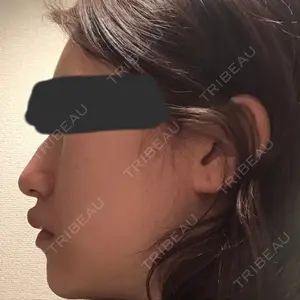 TL美容整形外科 TL美容整形外科 顔面輪郭・目・鼻センター口コミ