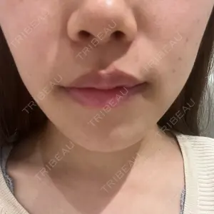 銀座みゆき通り美容外科 銀座みゆき通り美容外科 大阪梅田院口コミ
