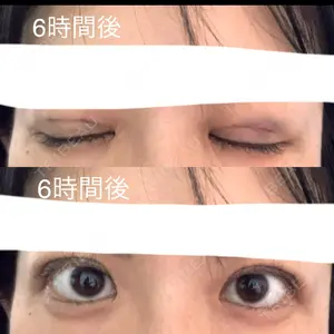 口コミ