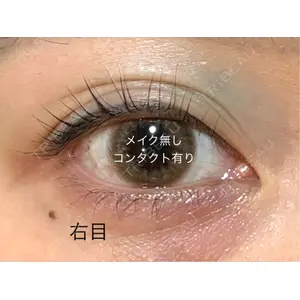 TCB東京中央美容外科 TCB東京中央美容外科 秋葉原院口コミ