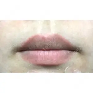 現代美学整形外科口コミ