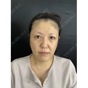 藤・ナチュレ美容クリニック 藤・ナチュレ美容クリニック 銀座院口コミ