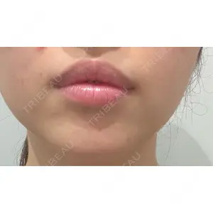 R Beauty CLINIC R Beauty CLINIC 銀座院口コミ