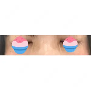 TCB東京中央美容外科 TCB東京中央美容外科 立川院口コミ