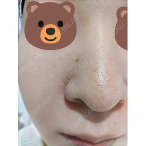 ブリリアスキンクリニック口コミ