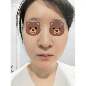 ブリリアスキンクリニック口コミ