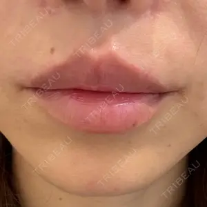 R Beauty CLINIC R Beauty CLINIC 銀座院口コミ