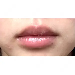 R Beauty CLINIC R Beauty CLINIC 銀座院口コミ