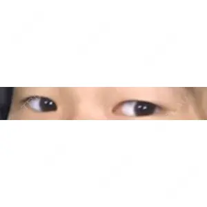 MIYAフェイスクリニック口コミ