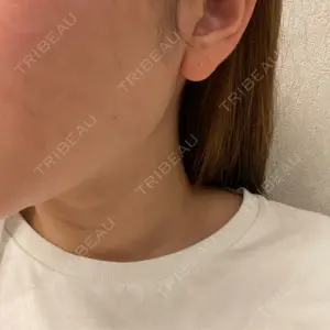 BiBiクリニック口コミ