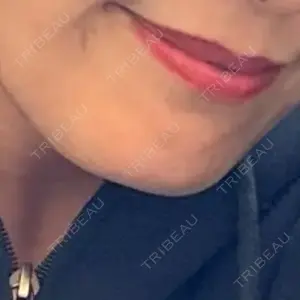 BiBiクリニック口コミ