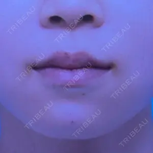 BiBiクリニック口コミ