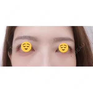 AYANAフィラーズクリニック AYANAフィラーズクリニック 渋谷院口コミ