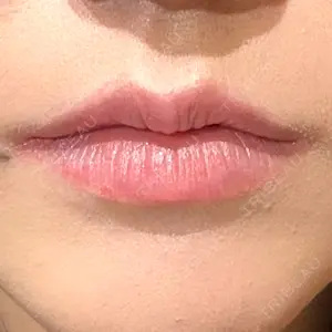 R Beauty CLINIC R Beauty CLINIC 銀座院口コミ