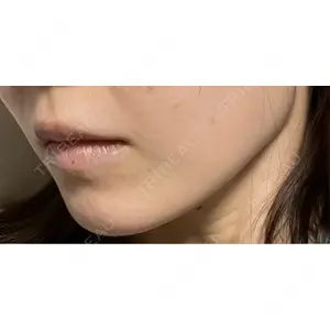 聖心美容クリニック グループ S-Laboクリニック 渋谷院口コミ