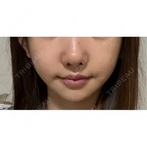 L‘amour clinic Tokyo【ラムールクリニック東京】口コミ