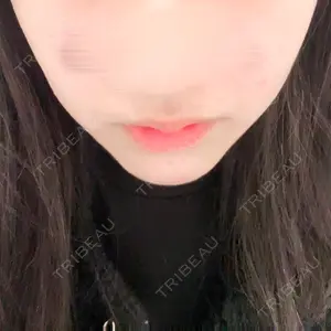 MIO CLINIC 梅田院口コミ
