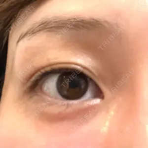 CHARIS BEAUTY CLINIC口コミ
