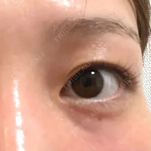 CHARIS BEAUTY CLINIC口コミ