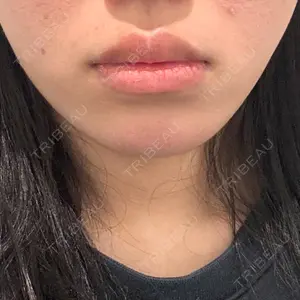 R Beauty CLINIC R Beauty CLINIC 銀座院口コミ