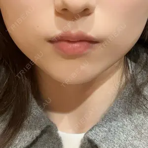 R Beauty CLINIC R Beauty CLINIC 銀座院口コミ